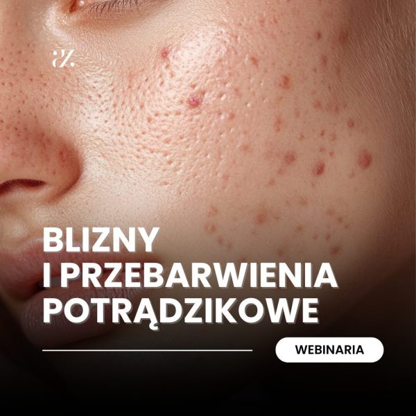 Webinarium: Blizny i przebarwienia potrądzikowe