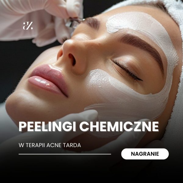 Nagranie: Peelingi chemiczne w terapii acne tarda