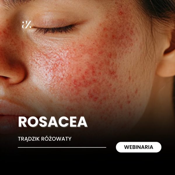 Webinarium: Rosacea - trądzik różowaty